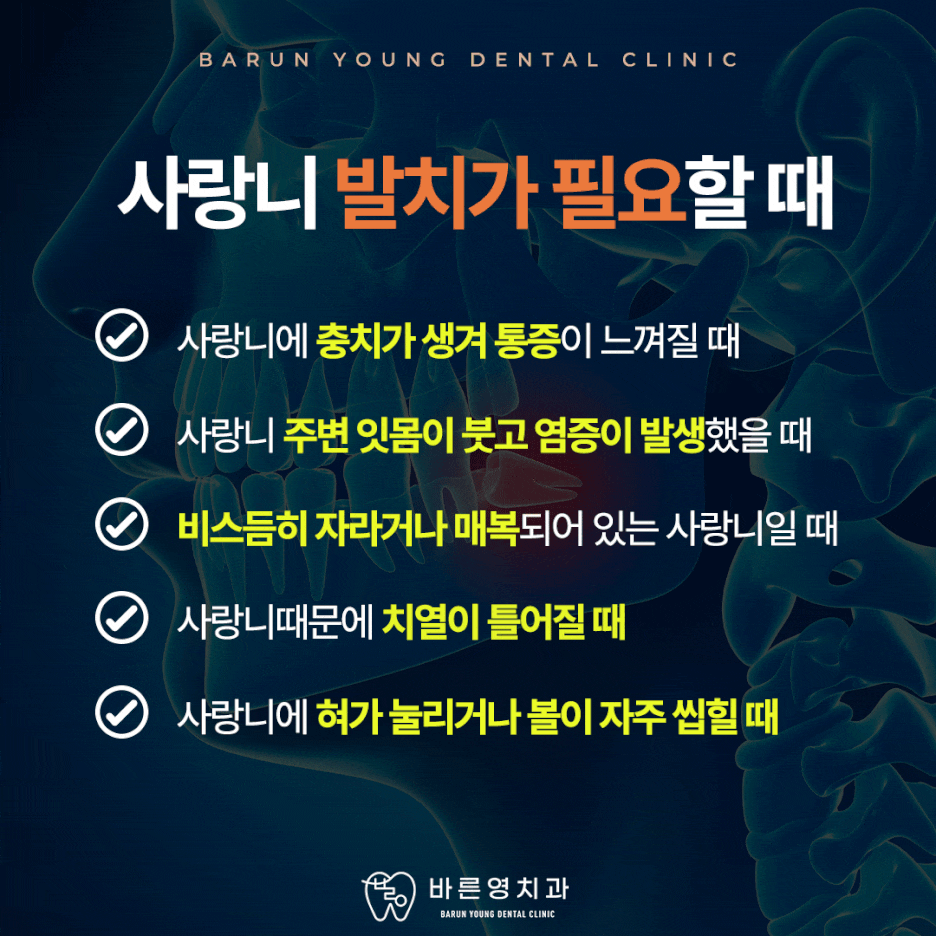 Why Wisdom Tooth Extraction is Important at Yaksu Station Dental Clinic 사진 4