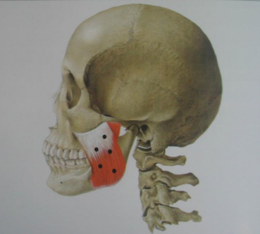 Klinik Gigi Stasiun Yaksu, Penyakit Terkait Sendi Temporomandibular (Perawatan Botox) 사진 4