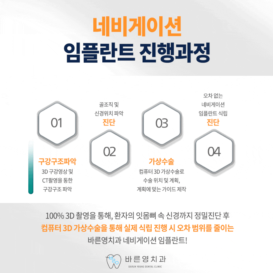 Yaksu Station Dental Clinic: Replacing Lost Teeth with Navigation Implants 사진 10