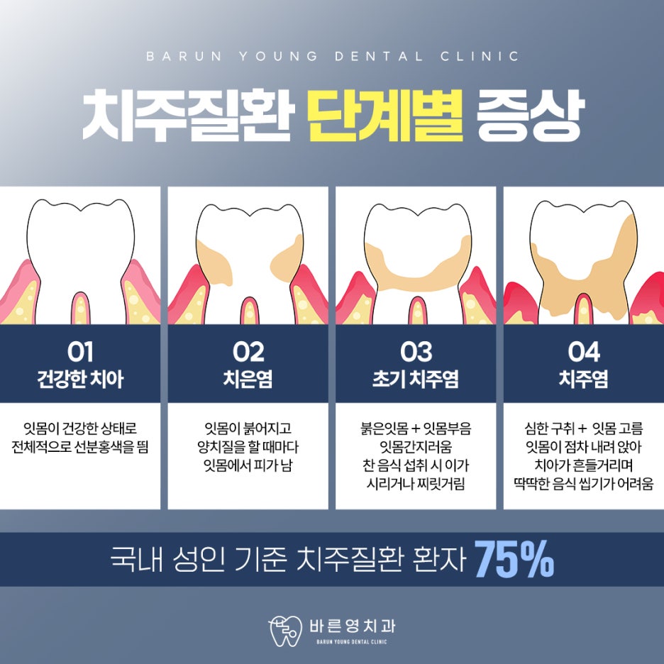 If Your Gums Keep Swelling, It's a Symptom of Periodontal Disease 사진 6