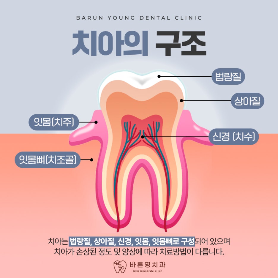 Jangan Lewatkan Waktu Perawatan Gigi Berlubang dan Perawatan Saraf di Klinik Gigi Cheonggu-dong 사진 6