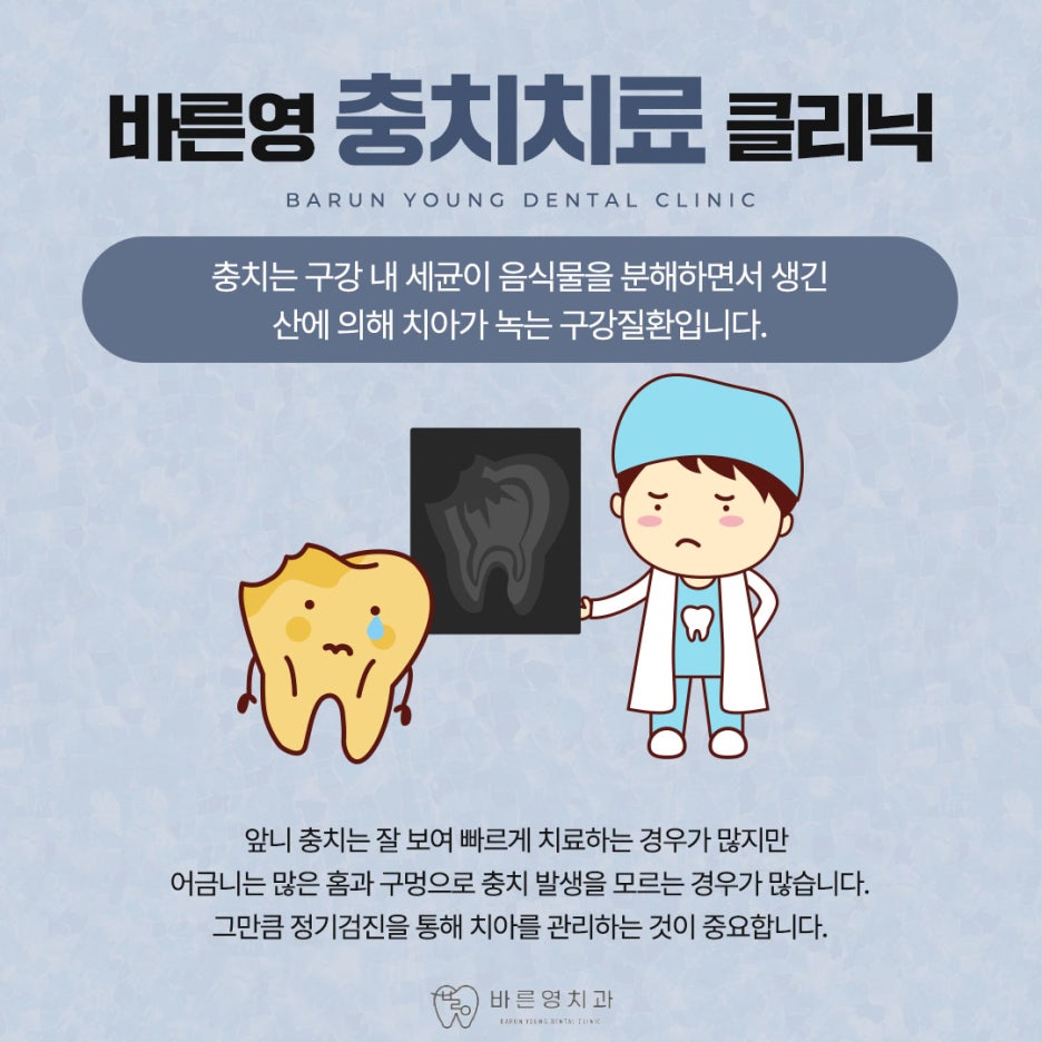 신당역치과 충치치료 자연치아 살리려는 것을 우선으로 사진 6