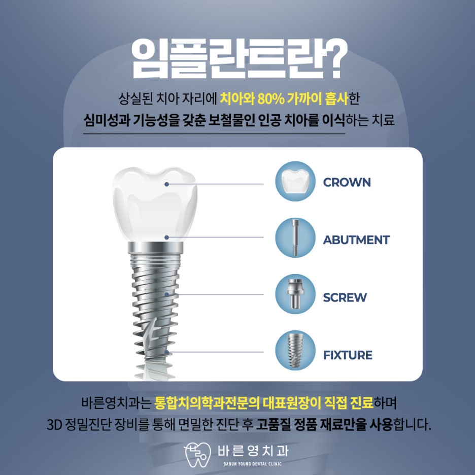 Kumho Station Dental Clinic: Navigation Implants – Knowing the Path Before Placement 사진 5
