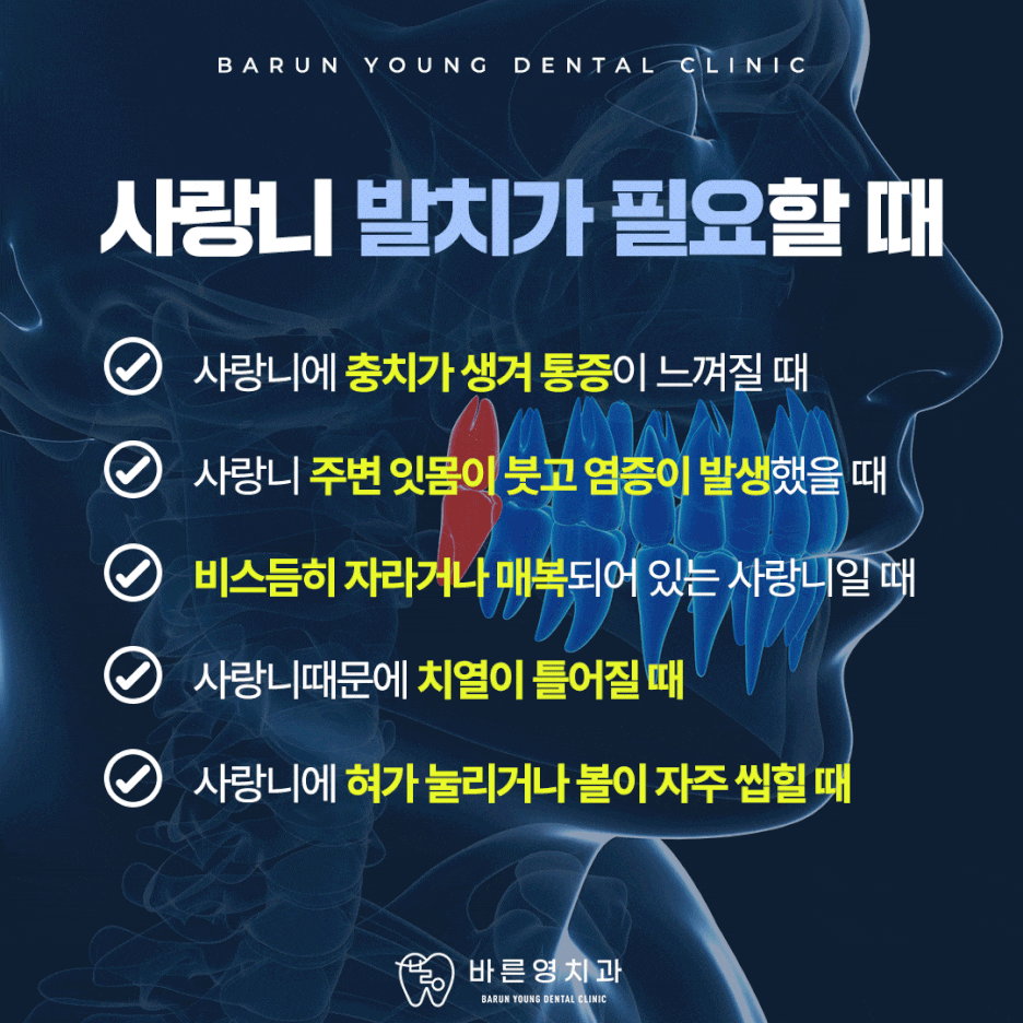 Dasan-dong Dental Clinic: When Same-Day Wisdom Tooth Extraction is Possible 사진 5