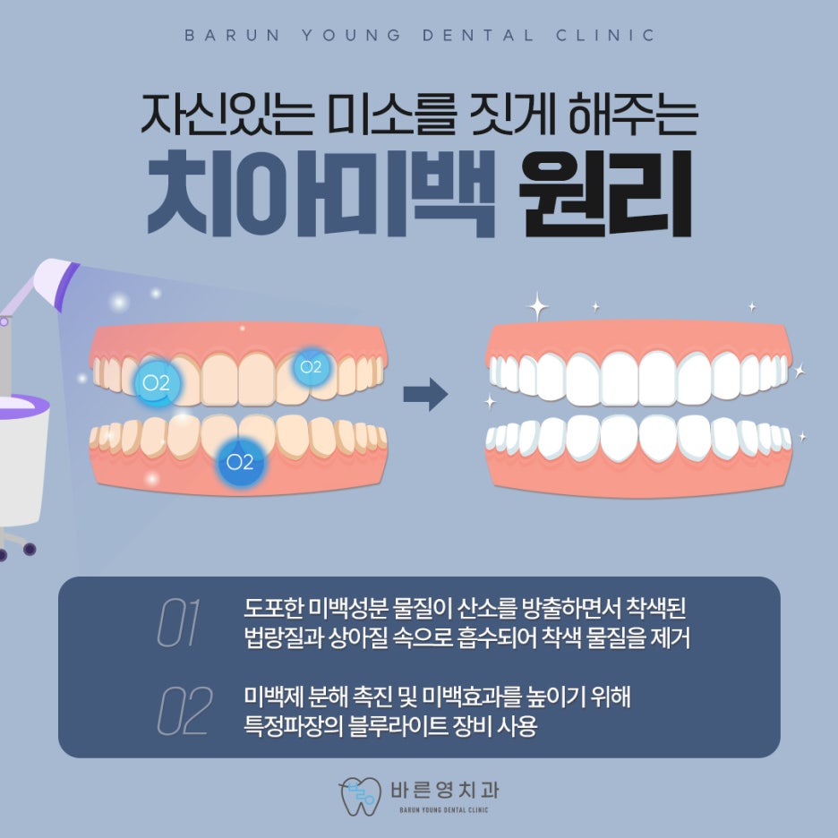 Shindang-dong Dental Clinic: Escape Stained, Discolored Yellow Teeth with Whitening Treatment 사진 5