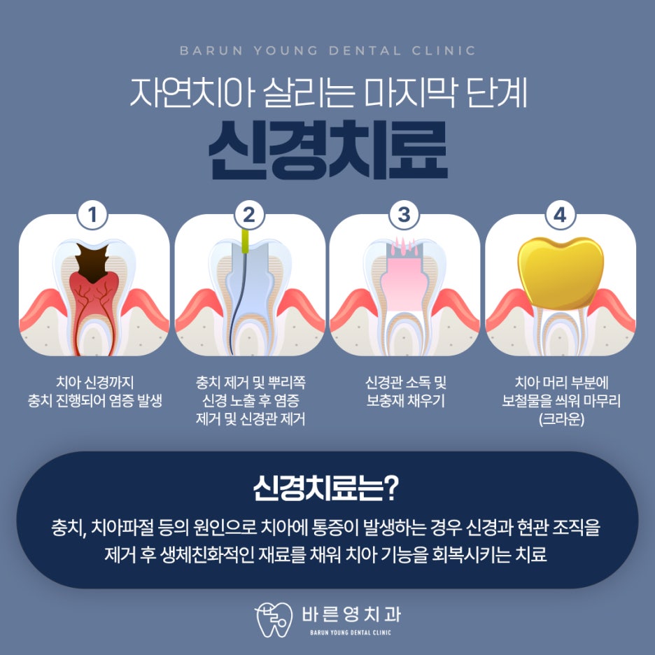 Shindang-dong Dental Clinic: Cavity and Root Canal Treatment at the Right Time for Long-Lasting Natural Teeth 사진 7