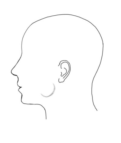 Shindang-dong Dental Clinic: Symptoms That May Appear After Jaw Botox Injections (Square Jaw, Masseter Muscle, 'Candy Ba