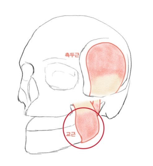 Shindang-dong Dental Clinic: Symptoms That May Appear After Jaw Botox Injections (Square Jaw, Masseter Muscle, 'Candy Ba