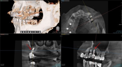 Shindang-dong Dental Clinic: Implant and Tooth Problems When Chewing Causes Pain