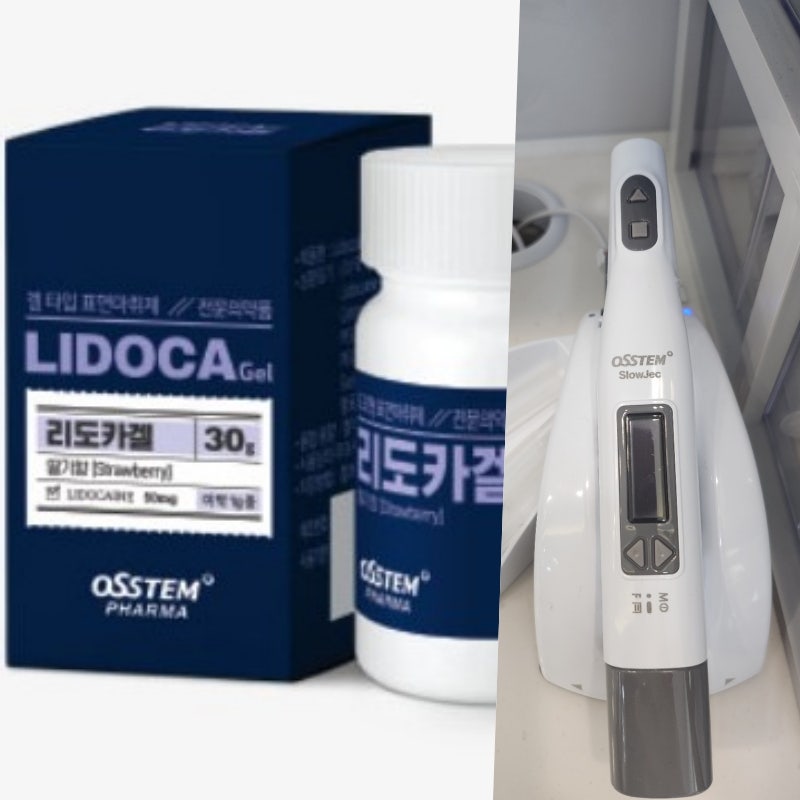 Shindang-dong Dental Clinic: The Impact of Long-Term Tooth Loss on Adjacent Teeth 사진 2