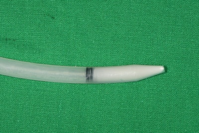 Implan Gigi di Sindang-dong: Operasi Implan (Sinus Lift) pada Gigi yang Hilang Lama 사진 5