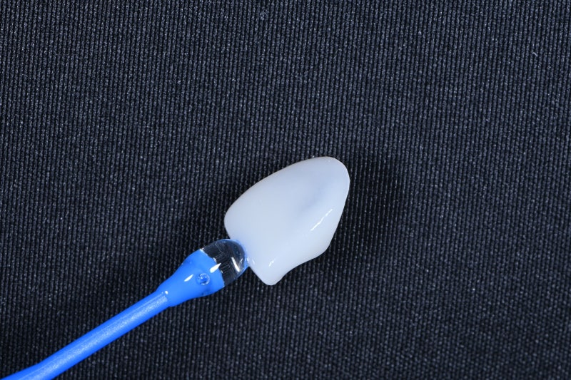 Dongdaemun No-Prep Veneers: When Past Orthodontic Treatment Makes Your Teeth Invisible When You Smile, Causing Stress 사진