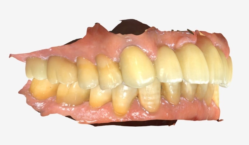 Hannam-dong Dental Clinic: Digital Implants Reduce Errors and Increase Comfort
