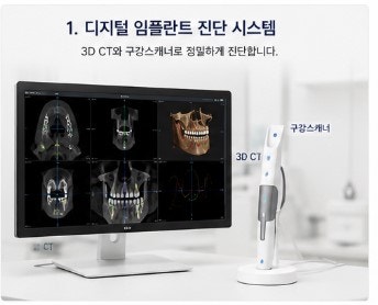 Operasi Implan yang Efisien dan Keunggulan Menggunakan Peralatan Digital di Klinik Gigi Yaksuyeok