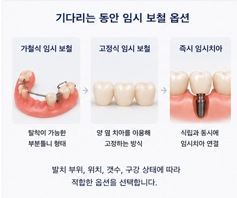 Yaksu Station Dental Clinic: How is the timing for implant placement after extraction determined? 사진 5