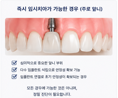 Yaksu Station Dental Clinic: How is the timing for implant placement after extraction determined? 사진 6