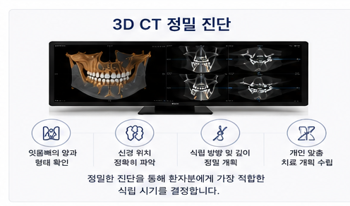Yaksu Station Dental Clinic: How is the timing for implant placement after extraction determined?