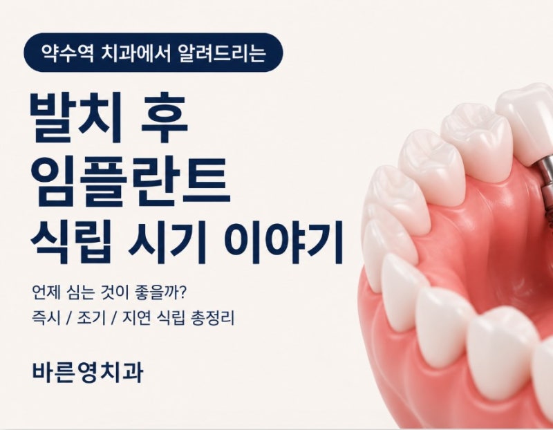 Yaksu Station Dental Clinic: How is the timing for implant placement after extraction determined?
