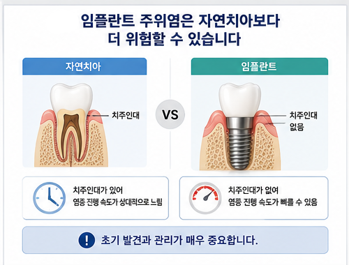 Yaksu Station Dental Clinic: Can Implants Also Get Gum Disease? 사진 3