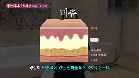 청담 피부과 버츄RF 같은 고주파 레이저는 아닙니다 사진 11
