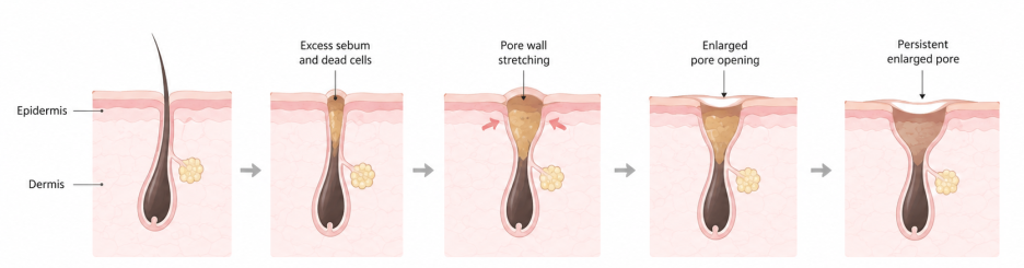 청담 피부과 버츄RF 같은 고주파 레이저는 아닙니다 사진 8