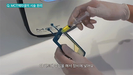 PRP와 MCT 자가엑소좀, 차이는 어디에 있을까요?