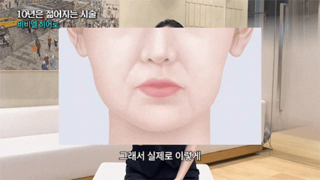 기미없애는법, BBL히어로와 MOXI레이저 복합치료 효과는 사진 9