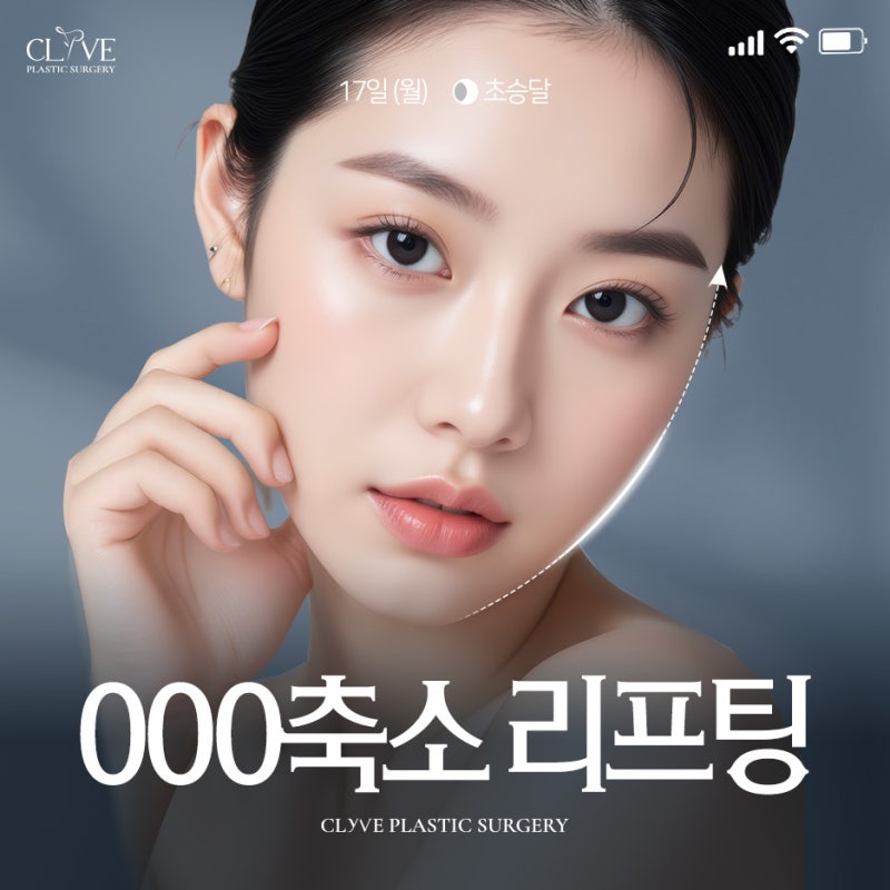Cheongdam Plastic Surgery: Thread Lift for Mid-Face Reduction - Clyve Plastic Surgery