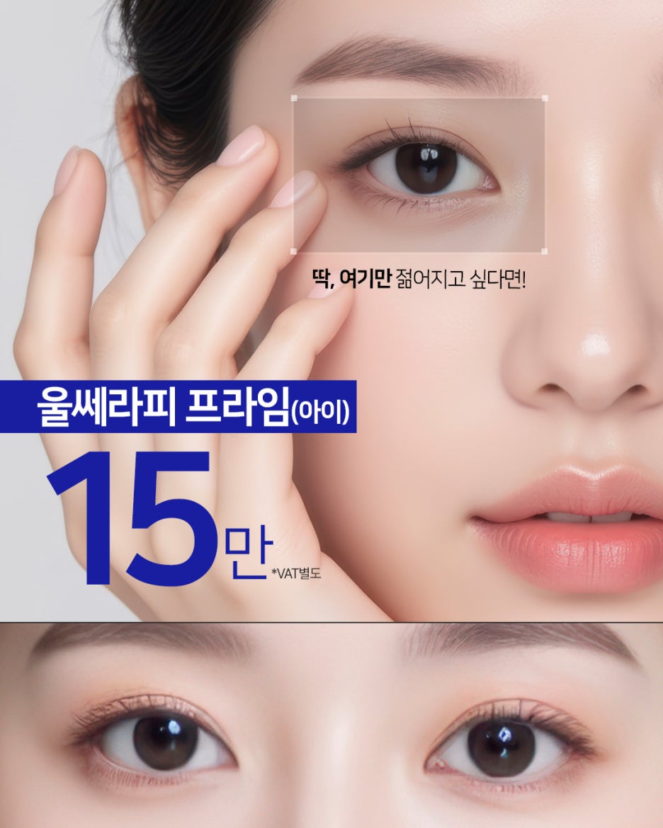 Gangnam Station Ultherapy with Sedation: Effects, Pain, and Duration
