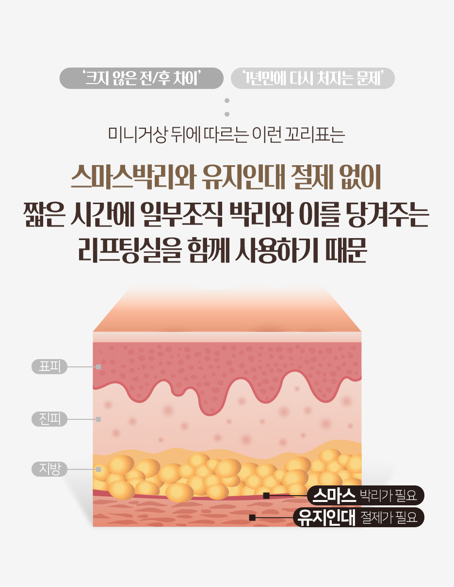 이마거상수술 후 다시 처질 수 있나요? 내시경이마거상 전 확인할 점 (역삼성형외과) 사진 5