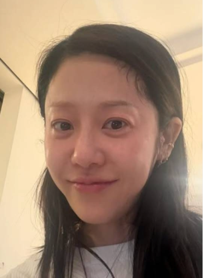"이거만 해도 10살은 어려 보입니다" 40대 50대 피부 시술Ⅰ즉각적인 효과 Ⅰ동안 연예인 공통점 사진 4