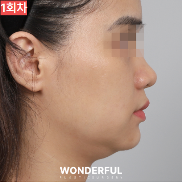 가을에 살이 더 잘빠지는 이유 3가지, 이중턱 빼는 팁 공유! 사진 11