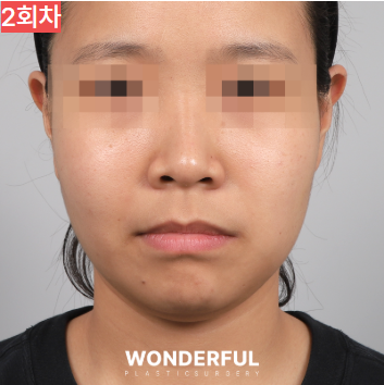 가을에 살이 더 잘빠지는 이유 3가지, 이중턱 빼는 팁 공유! 사진 6
