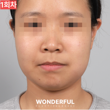 가을에 살이 더 잘빠지는 이유 3가지, 이중턱 빼는 팁 공유! 사진 5