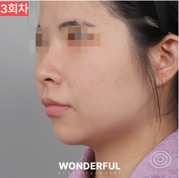 가을에 살이 더 잘빠지는 이유 3가지, 이중턱 빼는 팁 공유! 사진 10