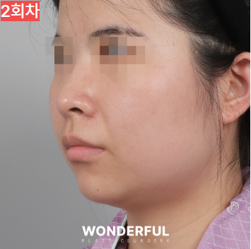 가을에 살이 더 잘빠지는 이유 3가지, 이중턱 빼는 팁 공유! 사진 9