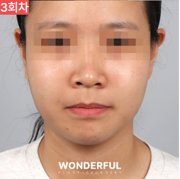 가을에 살이 더 잘빠지는 이유 3가지, 이중턱 빼는 팁 공유! 사진 7