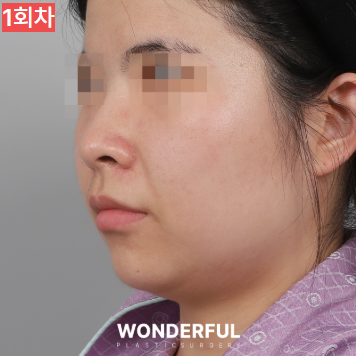 가을에 살이 더 잘빠지는 이유 3가지, 이중턱 빼는 팁 공유! 사진 8