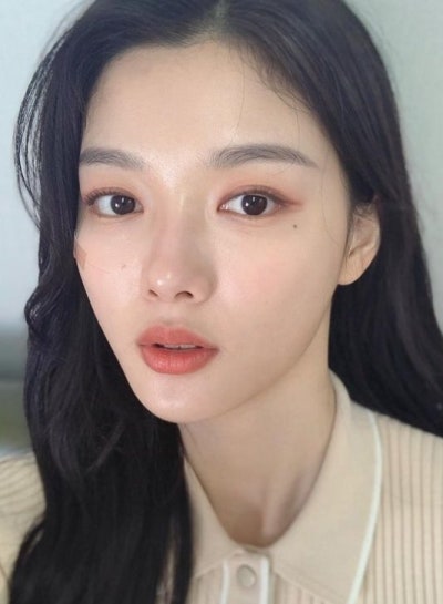 콧볼축소 수술? 필요 없습니다. (실제고객 사례) 사진 2