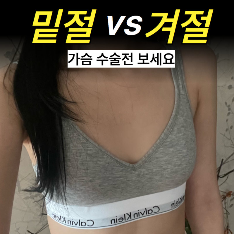 밑절 vs 겨절, 흉터 위치와 특징 완벽 비교