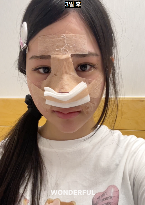성형수술 상담, 이것만은 꼭 물어보세요! 꼭 해야 하는 질문 5가지 사진 5