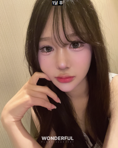 성형수술 상담, 이것만은 꼭 물어보세요! 꼭 해야 하는 질문 5가지 사진 8