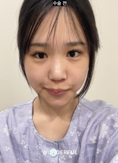 성형수술 상담, 이것만은 꼭 물어보세요! 꼭 해야 하는 질문 5가지 사진 7