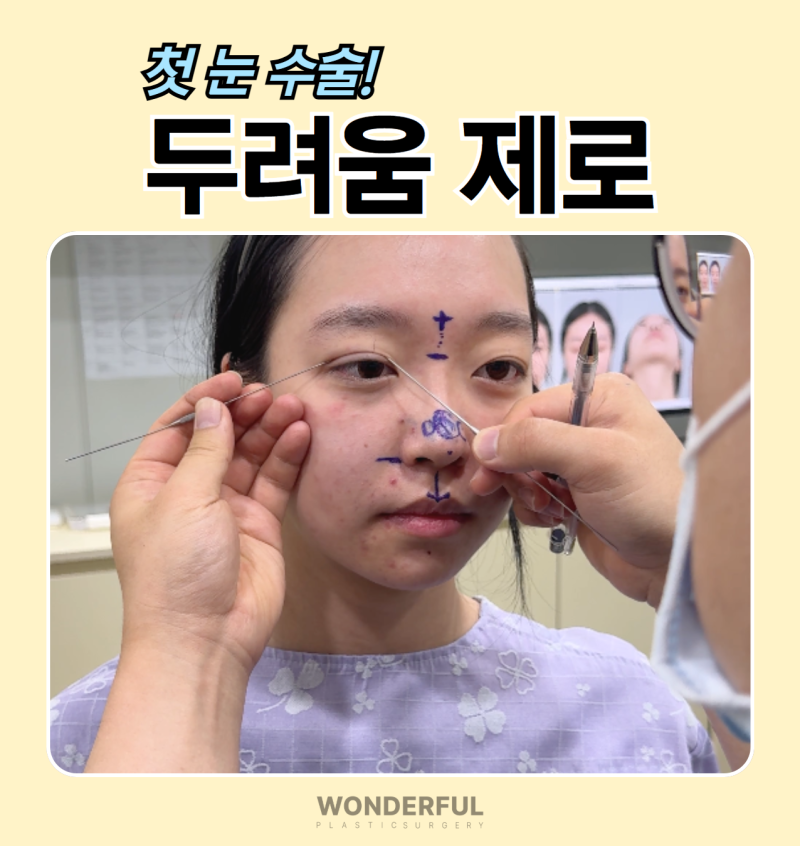 (7월 한정) 원더풀 성형외과 눈성형 추가금 없는 쌍수 가격 이벤트