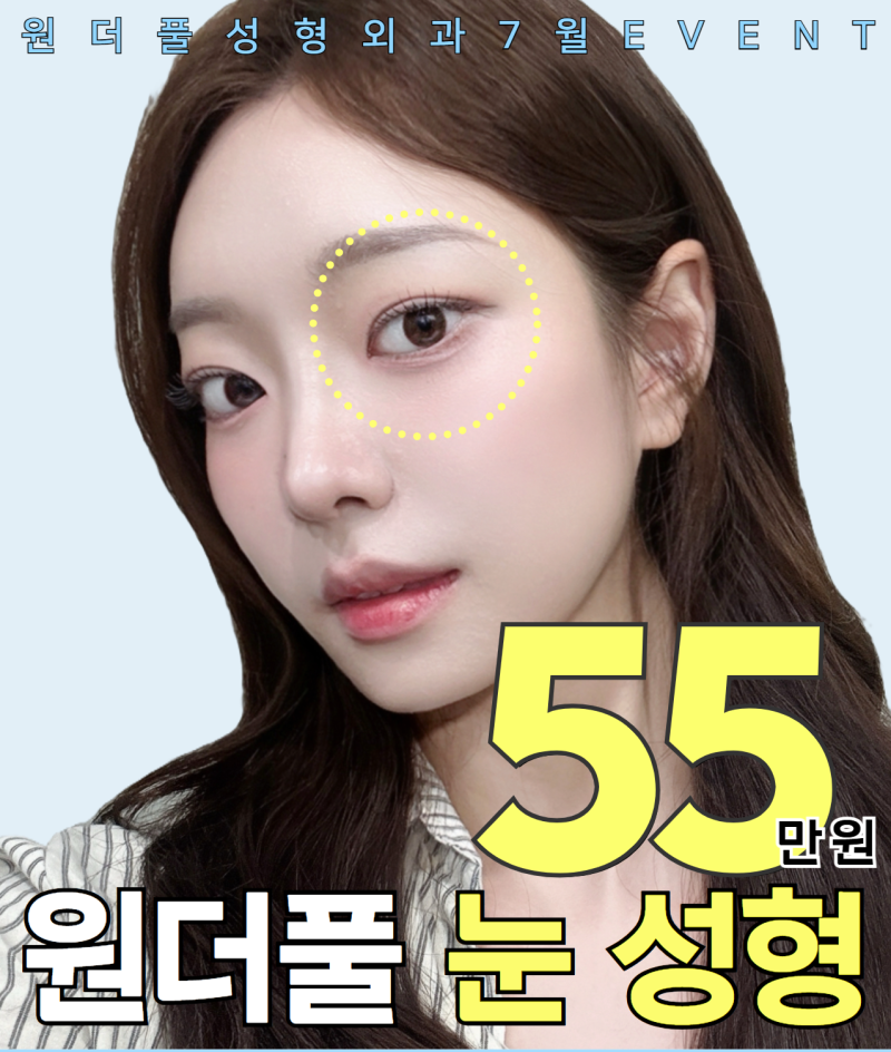 (7월 한정) 원더풀 성형외과 눈성형 추가금 없는 쌍수 가격 이벤트