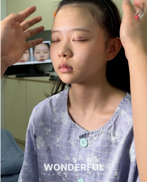 세미아웃라인, 예쁘게 될 수도 있지만 소세지눈이 될 수도 있습니다. 사진 2