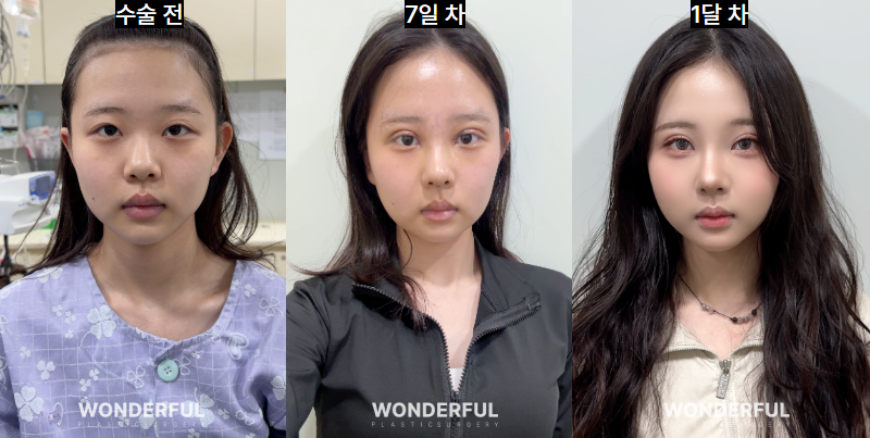 세미아웃라인, 예쁘게 될 수도 있지만 소세지눈이 될 수도 있습니다.