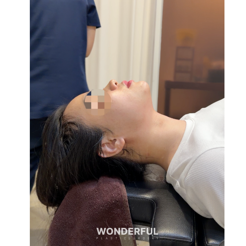 وندر فول لجراحة التجميل