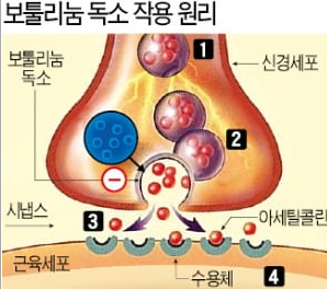 스킨보톡스 효과 (가성비갑 of 갑) 사진 2