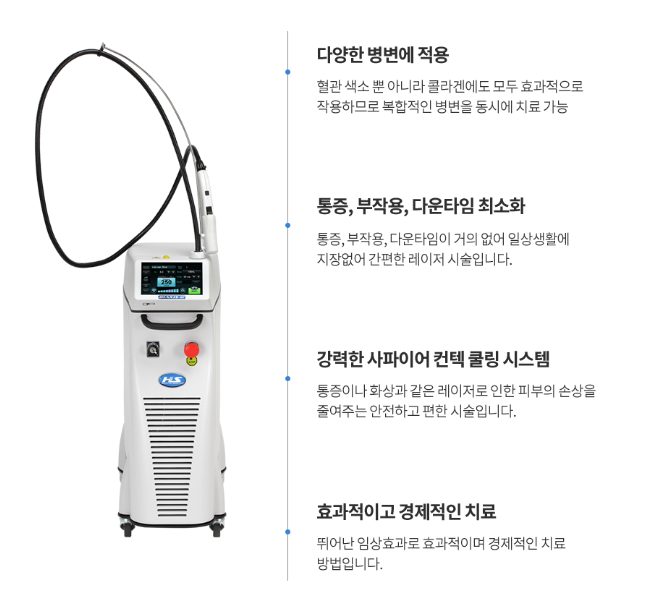 안면홍조 치료와 후기
